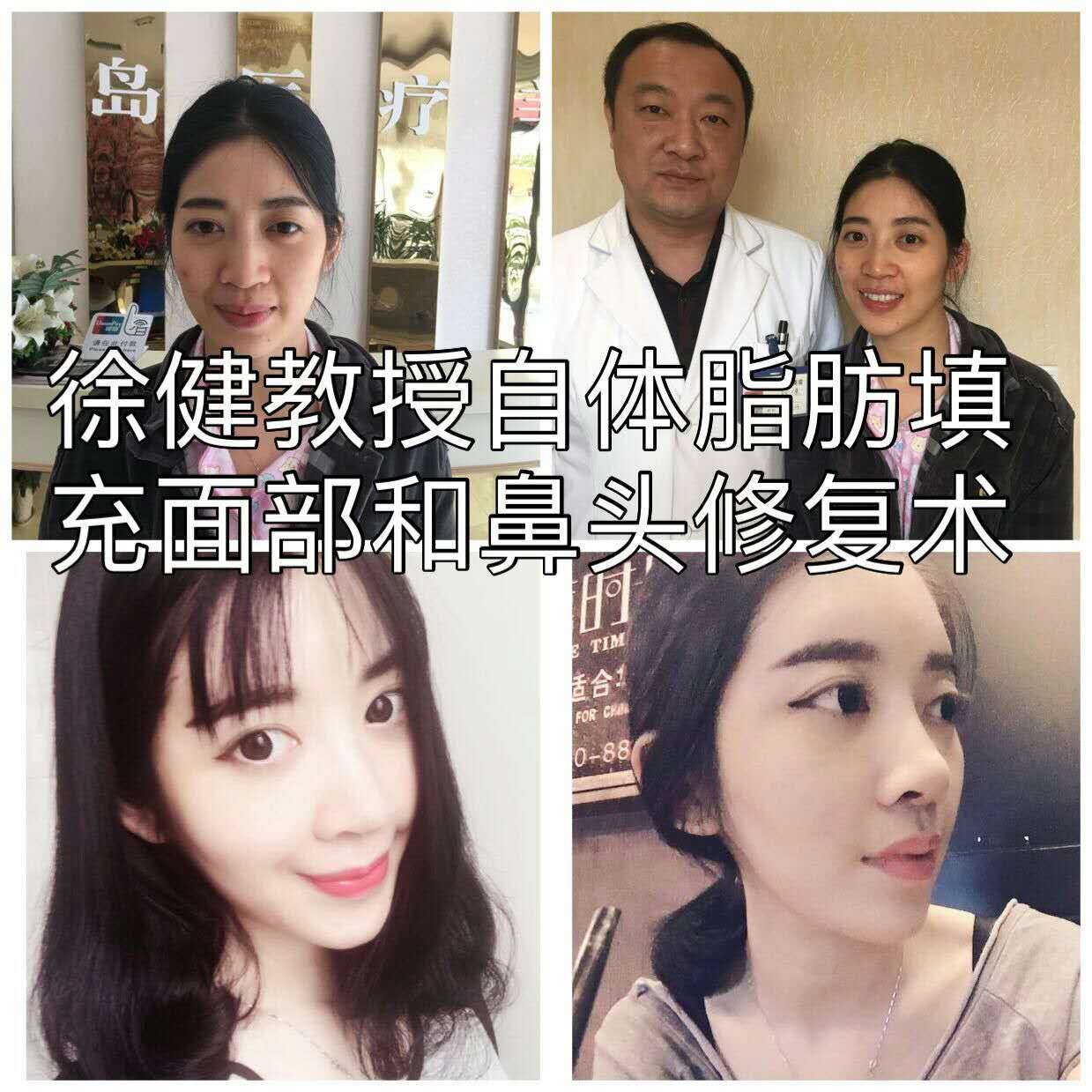 青島市南區(qū)雙眼皮開眼角哪家專業(yè)|金島整形