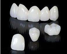 青島開(kāi)發(fā)區(qū)全瓷牙去哪家/黃島沈氏口腔