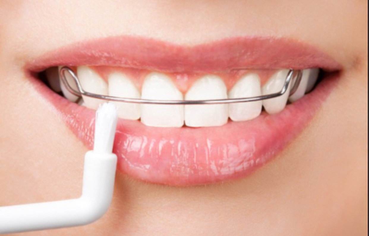 膠南牙齒冷光美白電話(huà)/黃島沈氏口腔